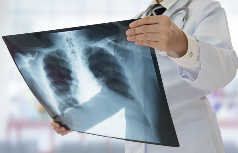 Τζανάκης για σύνδρομο «λευκού πνεύμονα»: Μάλλον δεν είναι νέος ιός η πνευμονία που «χτυπάει» τα παιδιά