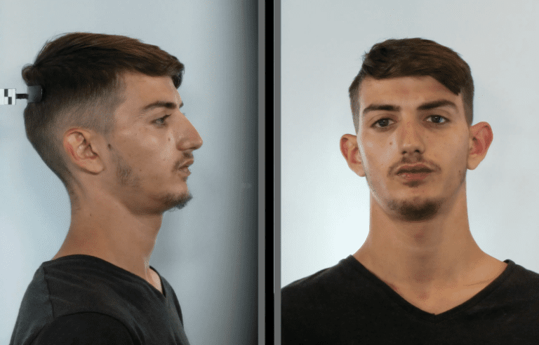 Αυτός είναι ο 21χρονος που λήστευε με μαχαίρι περαστικούς σε Καλλιθέα και Νέα Σμύρνη